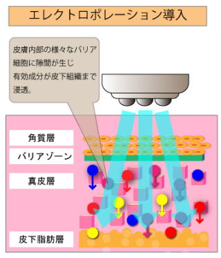 �G���N�g���|���[�V�����d�g��