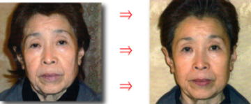 �G���N�g���|���[�V�������ʂQ