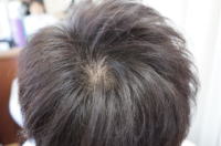 ���R�ȏk�ы����U